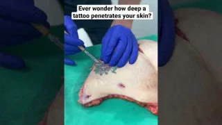 Ever wonder how deep a tattoo penetrates your skin?!😱 #mommymakeover #liposuction #tummytuck