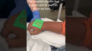 Vein Finder Devices