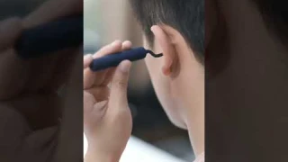 Bebird Earwax Cleaner with 10MP HD Camera Safe Earwax Removal Tool with 6 LED Lights.