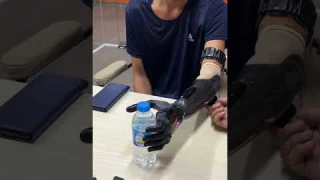 Vulcan Upper Limb Prosthetic Arm Fitting Day #shorts