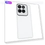 Electroplated Camera Frame TPU Phone Cover — Basic Cases, Smartwatch 2025