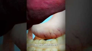 How Food Turns Into Poop😨