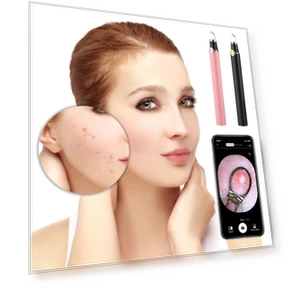 Smart Visual Blackhead Remover — Blackhead & Blemish Removers, YiGeiWoLiGiaoGiao
