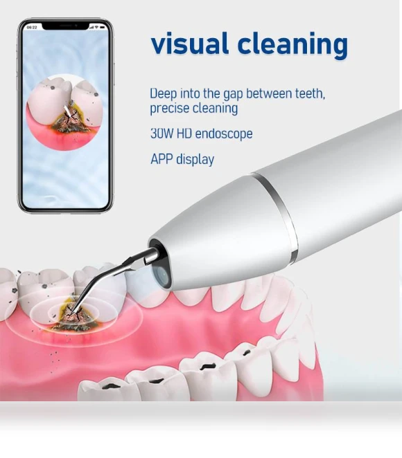 Intelligent Visual Home Dental Scaler Ultrasonic Scaler — Ultrasonic Scalers, SUNUO