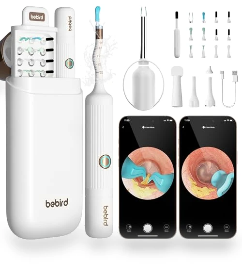 Earsight Plus Ear Wax Removal Tool Camera — Wax Removal, BEBIRD