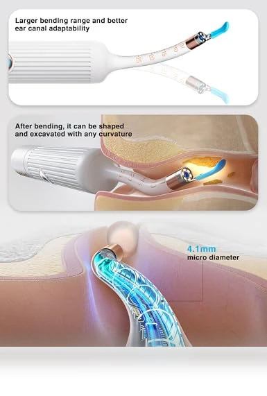 Earsight Plus Ear Wax Removal Tool Camera — Wax Removal, BEBIRD