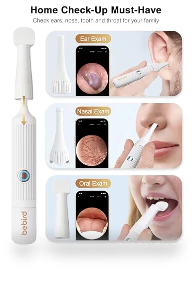 Earsight Plus Ear Wax Removal Tool Camera — Wax Removal, BEBIRD