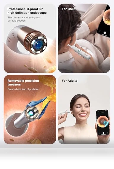 Earsight Plus Ear Wax Removal Tool Camera — Wax Removal, BEBIRD