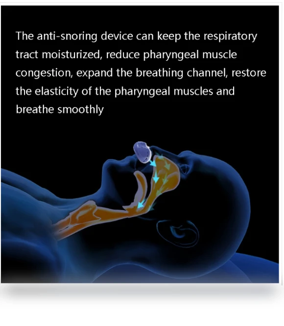 Portable rechargeable electric anti-snoring device — Snore Reducers