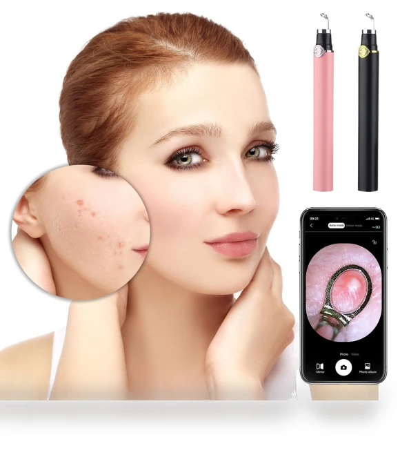 Smart Visual Blackhead Remover — Blackhead & Blemish Removers, YiGeiWoLiGiaoGiao