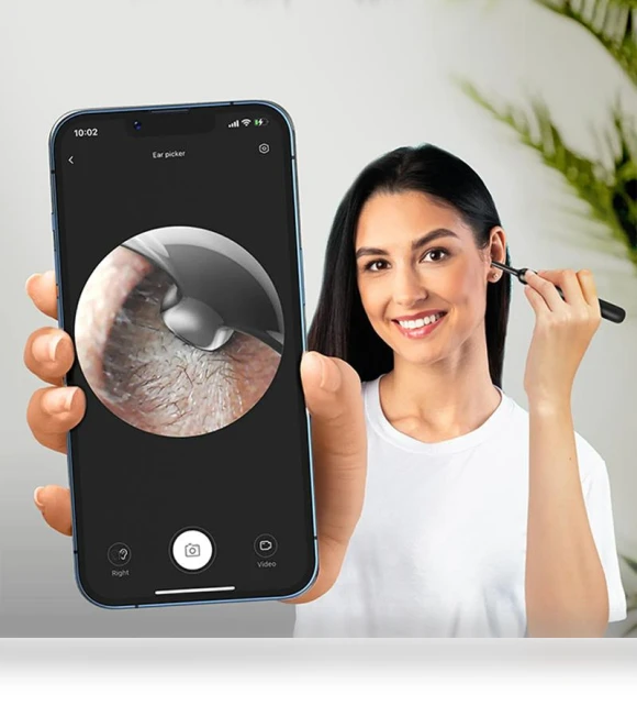 Wireless Ear Wax Camera — Wax Removal, Home Whispers