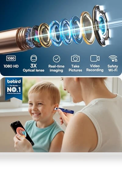 Flexible Ear Wax Removal Tool Camera — Wax Removal, BEBIRD
