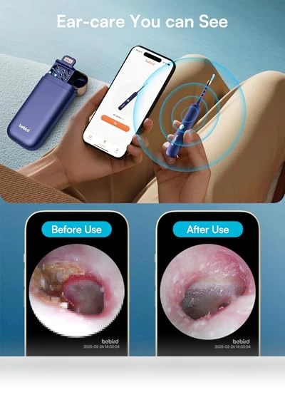 Flexible Ear Wax Removal Tool Camera — Wax Removal, BEBIRD