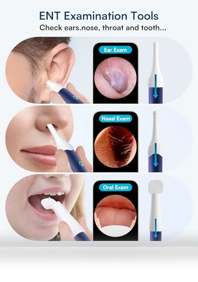 Flexible Ear Wax Removal Tool Camera — Wax Removal, BEBIRD