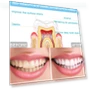 Thumbnail Wire Control Tooth Set Accessories — Orthodontic Care Essentials