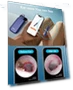 Thumbnail Flexible Ear Wax Removal Tool Camera — Wax Removal, BEBIRD