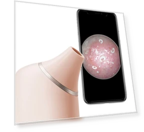 AI Visual Blackhead Remover Camera — Blackhead & Blemish Removers