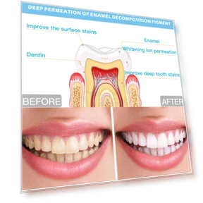 Wire Control Tooth Set Accessories — Orthodontic Care Essentials