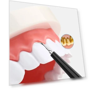 Oral Tooth Cleaning and Care Tool — Dental Hygiene Essentials