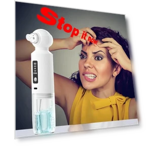 6-head blackhead cleaner — Blackhead & Blemish Removers, Aloisia