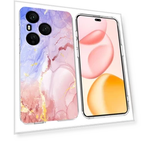 Marble Pattern Printing Soft TPU Phone Cover — Basic Cases, Smartwatch 2025