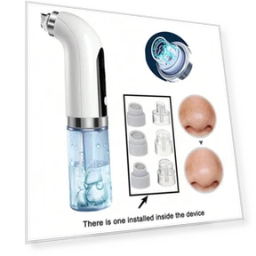 Vacuum Pore Cleaner — Blackhead & Blemish Removers, Binchi