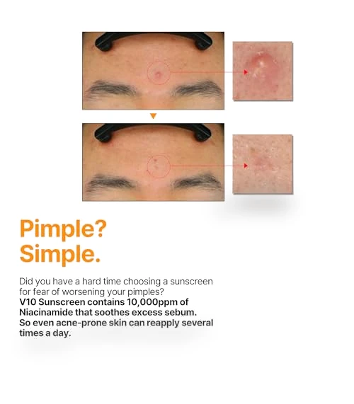 V10 Hyal Air Fit Sunscreen SPF 50 - Korean Centella Sunscreen for Sensitive Skin — Post-Sun Care, SOME BY MI