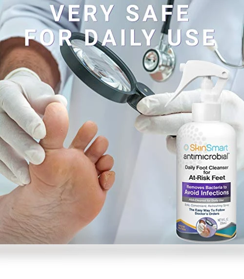 Daily Foot Cleanser Spray for At-Risk Feet, 8 ounce — Hand Wash, SkinSmart
