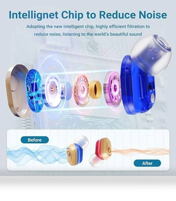 Rechargeable Hearing Aids — Hearing Support, XIYNBH