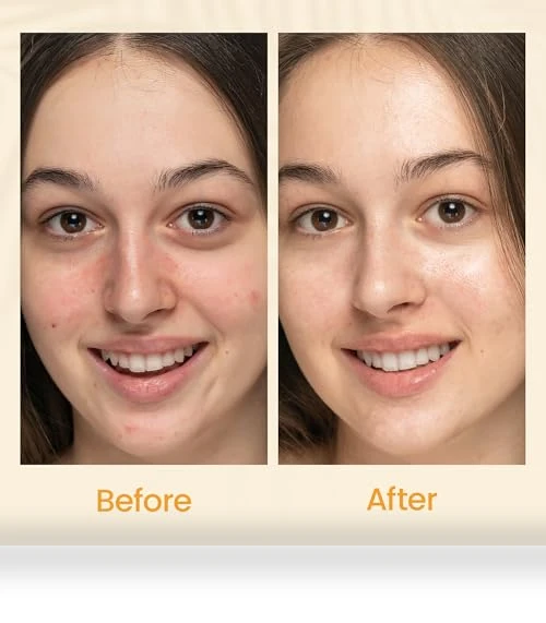 Gel Moisturizer for Face — Creams & Moisturizers, Honeyskin