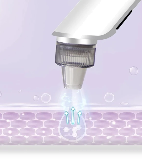Facial Cleaning Pore Vacuum — Blackhead & Blemish Removers