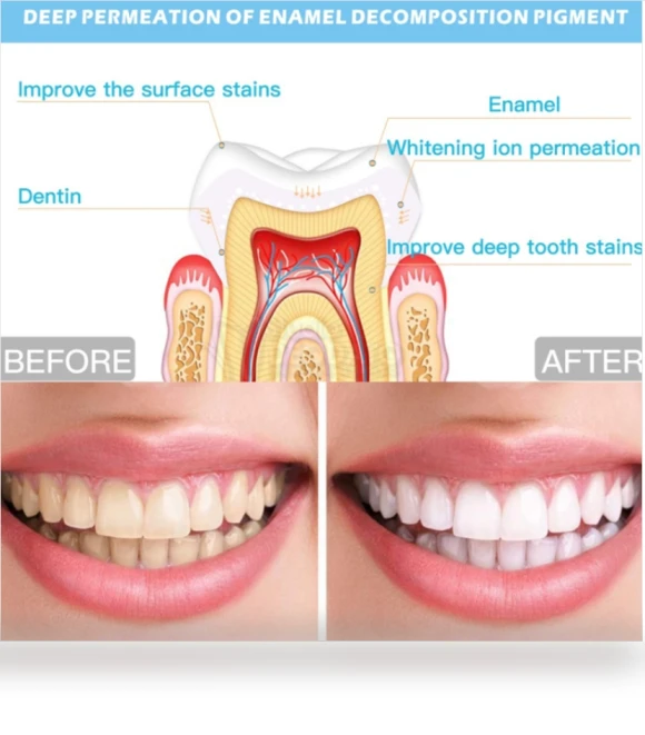 Wire Control Tooth Set Accessories — Orthodontic Care Essentials