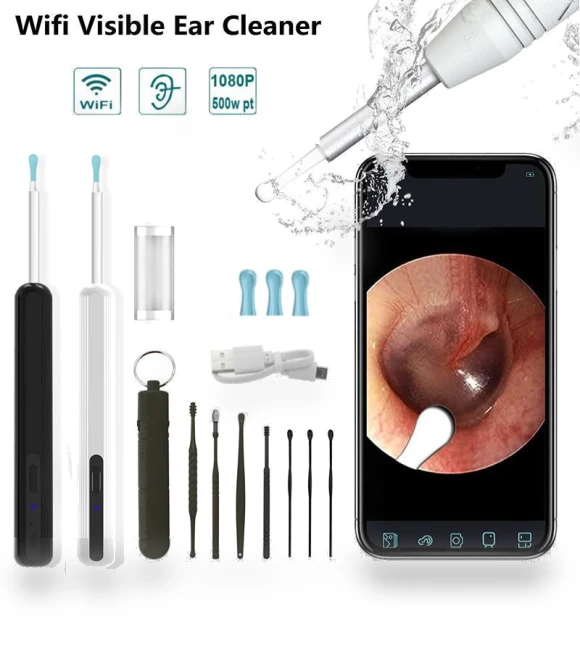 Smart Vision Wireless Ear Cleaning Spoon — Wax Removal, Meiteai-All