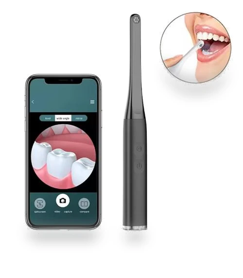 Visual Oral Observation Instrument — Headlights & Loupe Lights, FY