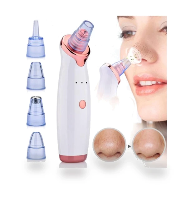 Electric Pore Cleaner — Blackhead & Blemish Removers, Arie7s
