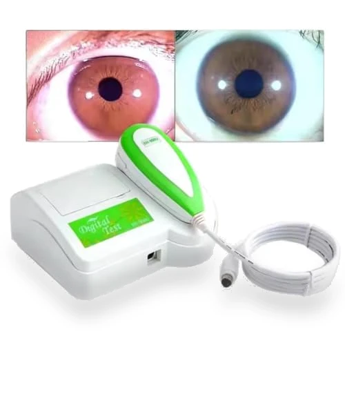 Iris Analyzer Camera — Pregnancy Health Monitors, QiQiBaby