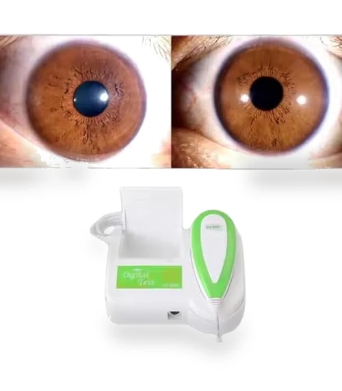 Iris Analyzer Camera — Pregnancy Health Monitors, QiQiBaby
