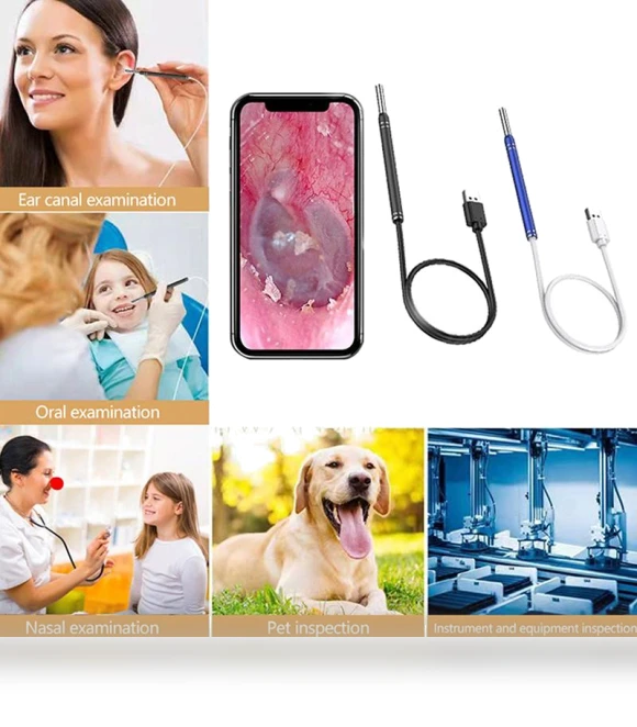 Smart Visual Ear Cleaner Endoscope Spoon — Syringes, Rejuvenationagp