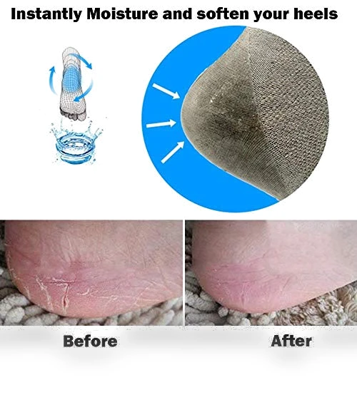 Vented Moisturizing Socks with Lotion Gel — Moisturizing Socks, Codream
