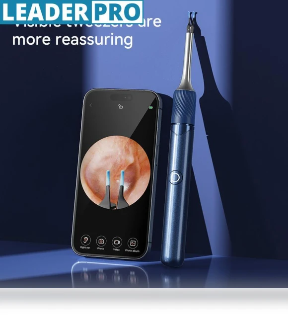 Wireless WiFi Endoscope — Wax Removal, Crown Global