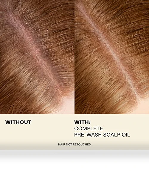 Complete Hair and Scalp Oil With Rosemary — Hair & Scalp Care, JVN