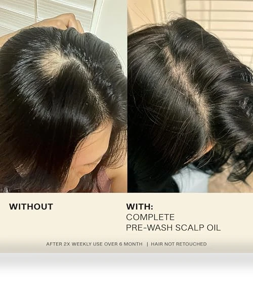 Complete Hair and Scalp Oil With Rosemary — Hair & Scalp Care, JVN