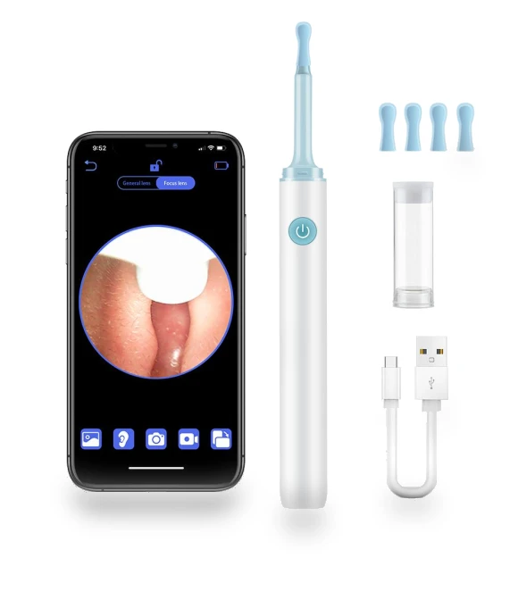 Wireless Wi-Fi Ear Cleaning Endoscope — Wax Removal, Cozy Cottage-Relax