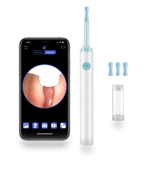 Smart WiFi Ear Cleaner — Wax Removal, Modern Home Furnishing