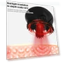Thumbnail Intelligent Head and Eye Massager — Back Relief Solutions, Yesido
