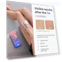 Thumbnail At Home Laser Hair Removal — Grooming Essentials, Braun