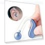 Thumbnail Wireless Invisible Charging Hearing Aid — Hearing Support