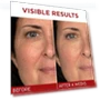 Thumbnail Revitalift Triple Power Anti-Aging Face Moisturizer — Beauty & Personal Care, L'OREAL PARIS