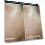 Thumbnail 5 in 1 Anti-Aging Daily Face Moisturizer — Facial Hydration, RoC