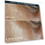 Thumbnail 5 in 1 Anti-Aging Daily Face Moisturizer — Facial Hydration, RoC